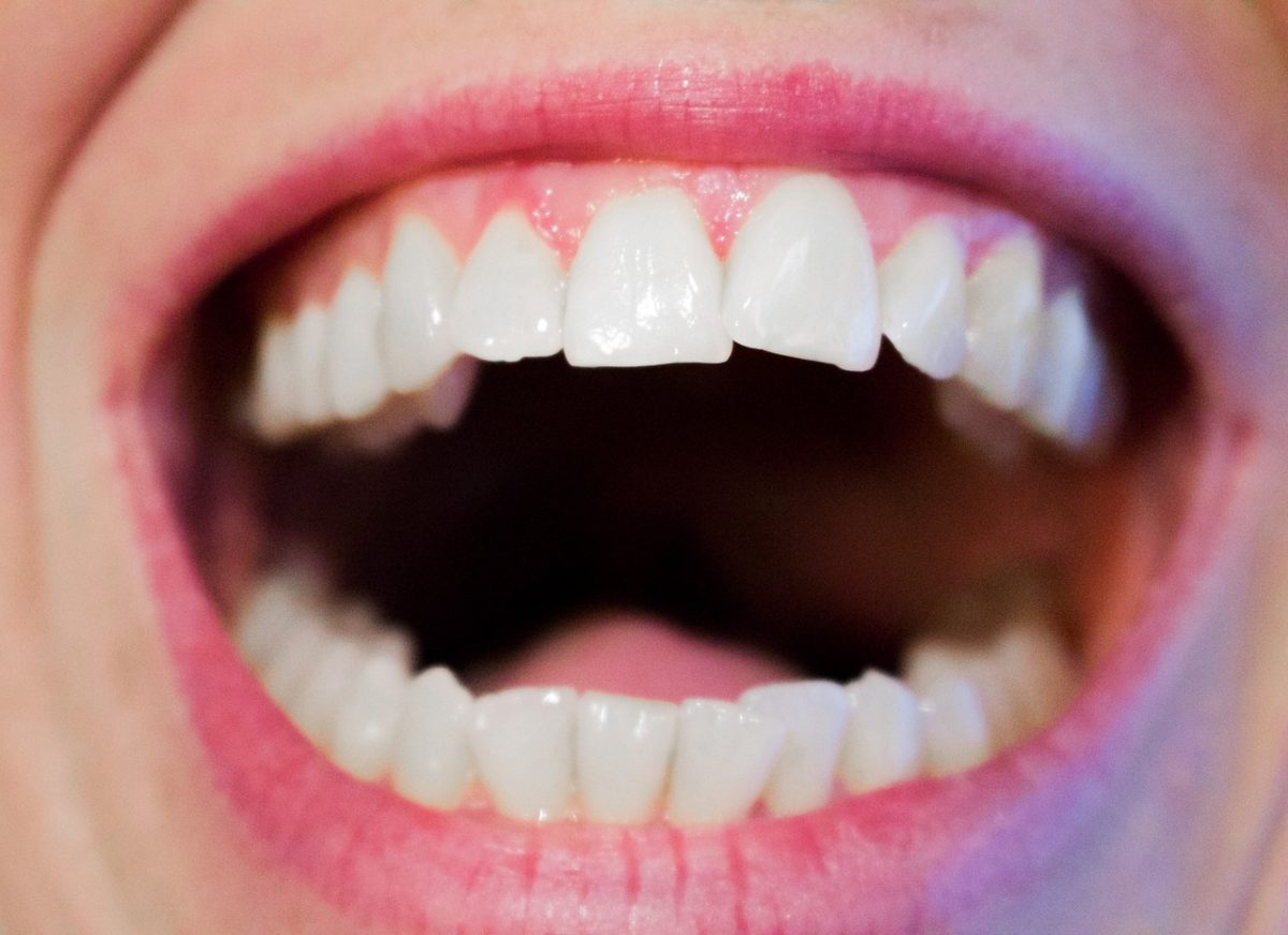 Dzisiejsza technika używana w salonach stomatologii estetycznej być może sprawić, że odbierzemy śliczny uśmiech.